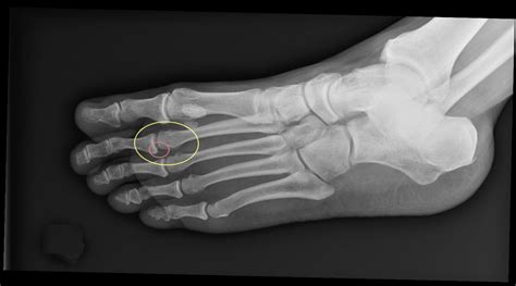 Can an X-ray Show a Torn Ligament? And Why Do Bananas Always Look So Happy?